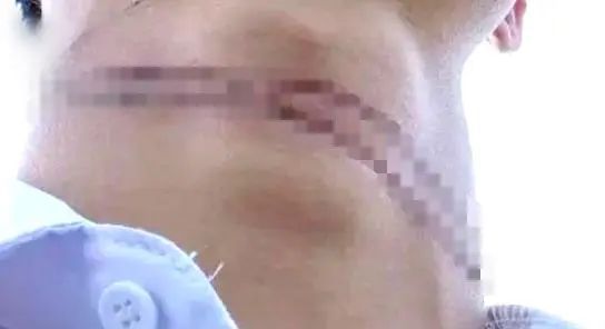 惊魂！当街被割！事发北京动物园附近！(图3)
