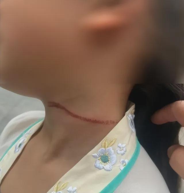 惊魂！当街被割！事发北京动物园附近！(图6)
